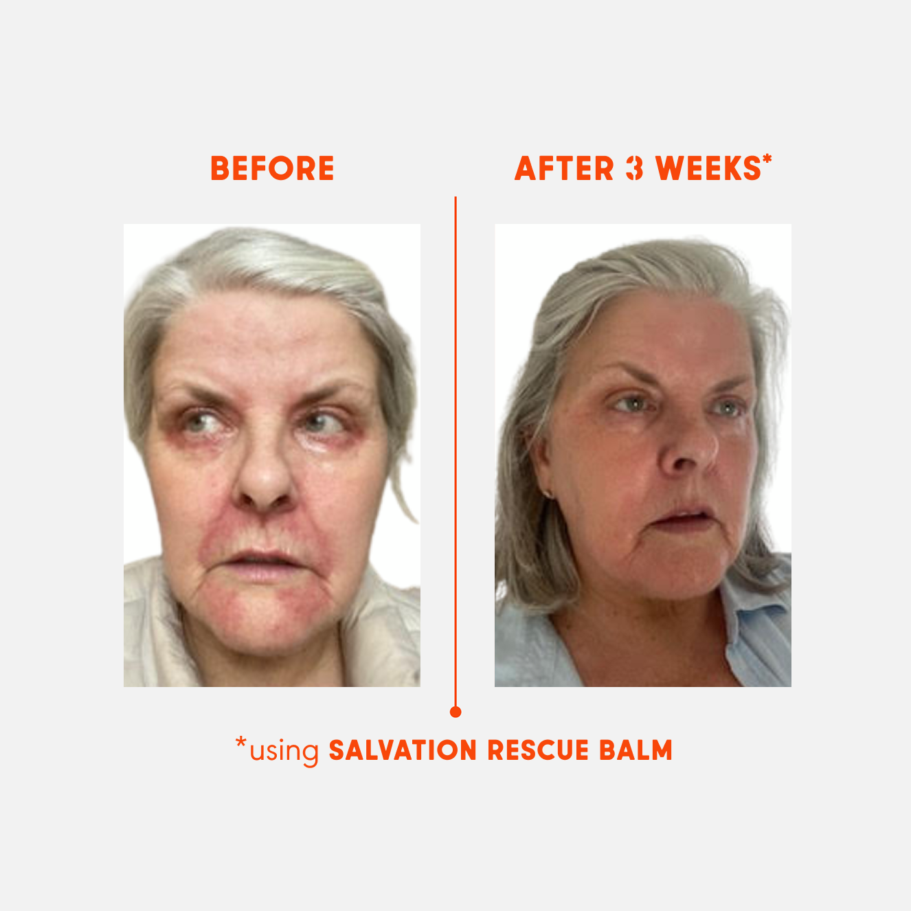 Mega Hydration Winter Repair